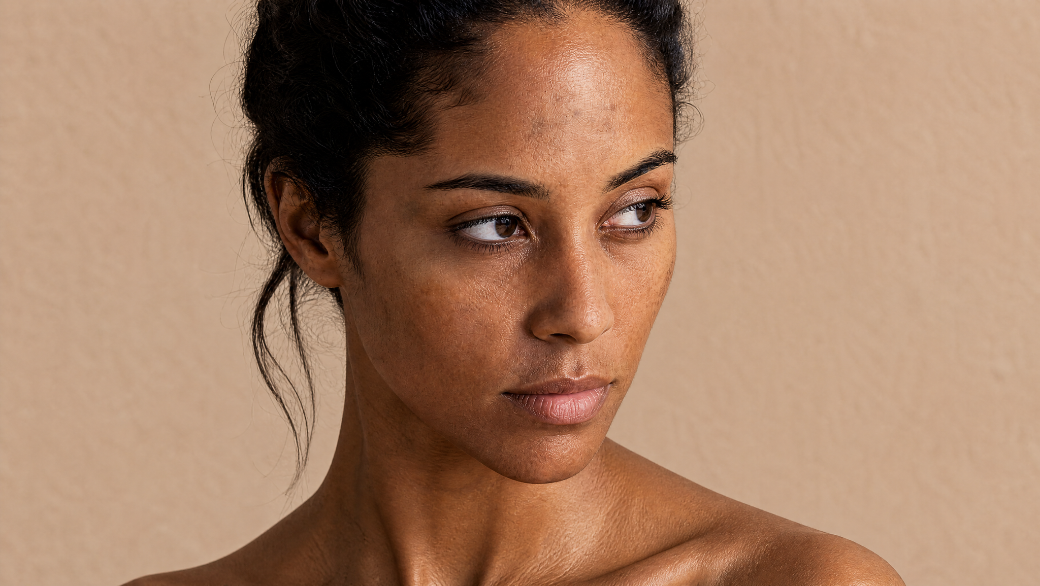 Can Melasma Affect Every Skin Tone? Why It Looks Different on Different Complexions