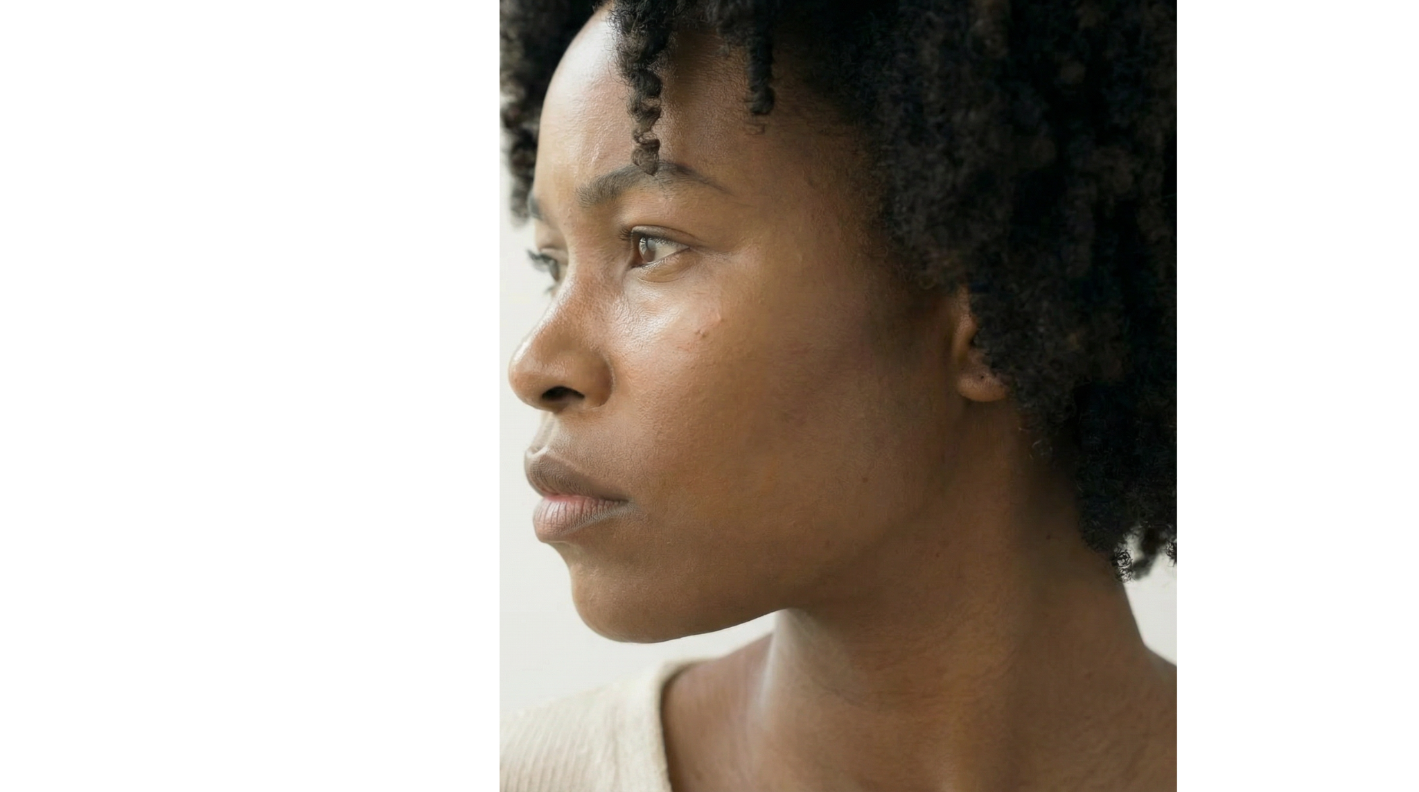 PIH, Lentigo, Melasma : How to Recognize Each Type of Dark Spot?